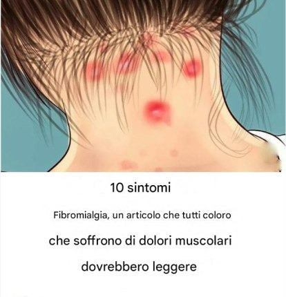 10 sintomi della fibromialgia che chiunque soffra di dolori muscolari dovrebbe leggere