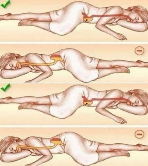 Dormire sul lato sinistro: una scelta benefica per la salute