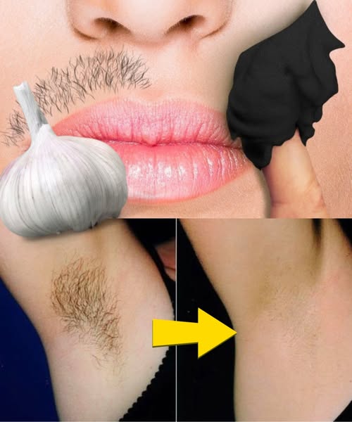 Smettila di raderti! Scopri i metodi naturali per rimuovere definitivamente i peli del viso, del corpo e della zona bikini