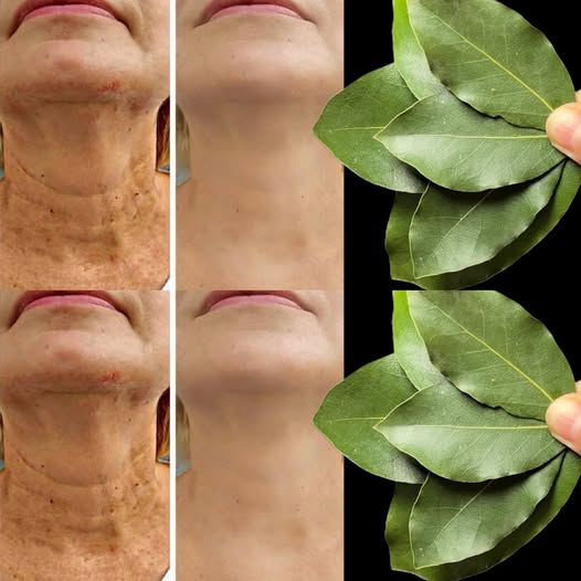 L’alloro è 100.000 volte più potente del Botox? | Antirughe naturale anche a 70 anni!