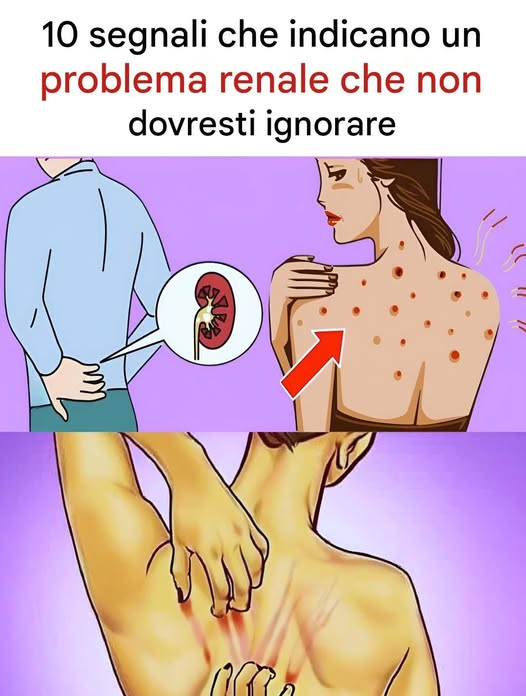 10 segnali che hai un problema renale