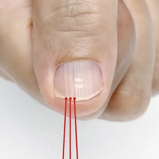 Cosa rivelano realmente quelle linee verticali sulle tue unghie